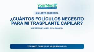 ¿Cuántos folículos necesito para mi trasplante capilar? | YourMed