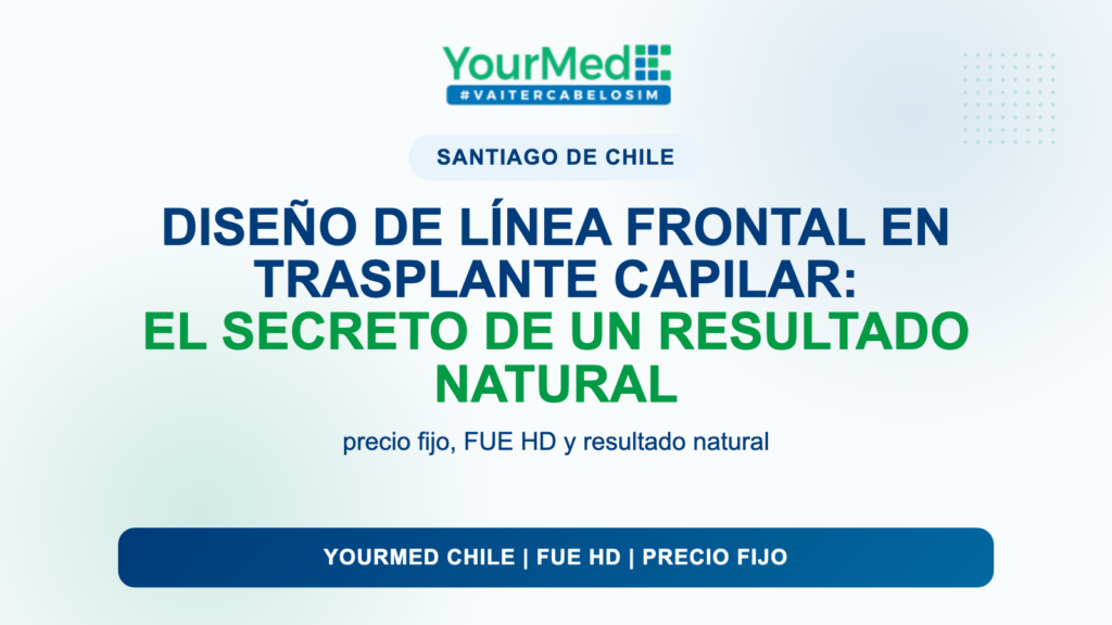 Diseño de línea frontal en trasplante capilar: el secreto de un resultado natural | YourMed