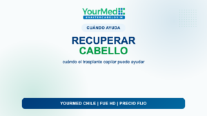 Recuperar el cabello en Santiago de Chile: cuándo el trasplante capilar puede ayudar | YourMed