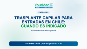 Trasplante capilar para entradas en Chile: cuándo es indicado | YourMed