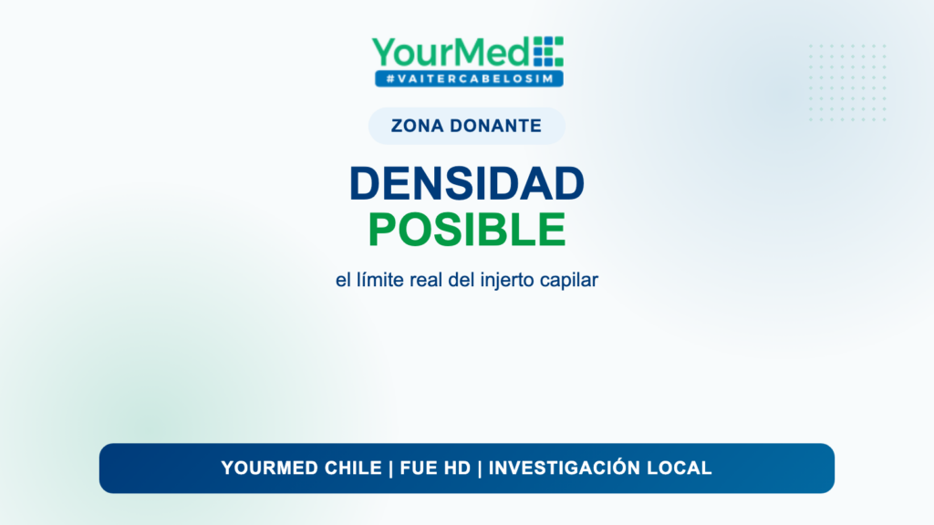 Zona donante en injerto capilar: por qué define la densidad posible en Chile | YourMed